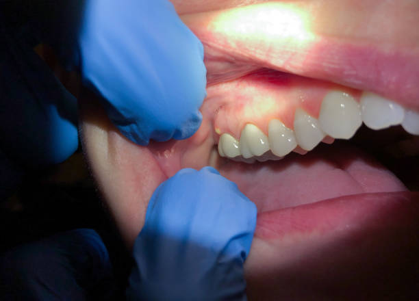 Best Cracked Tooth Emergency Dentist  in Liberal, KS