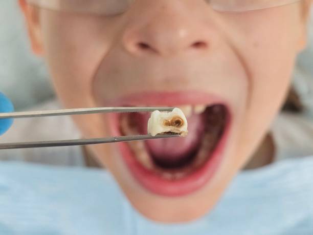 Best Dentist for Tooth Abscess  in Liberal, KS